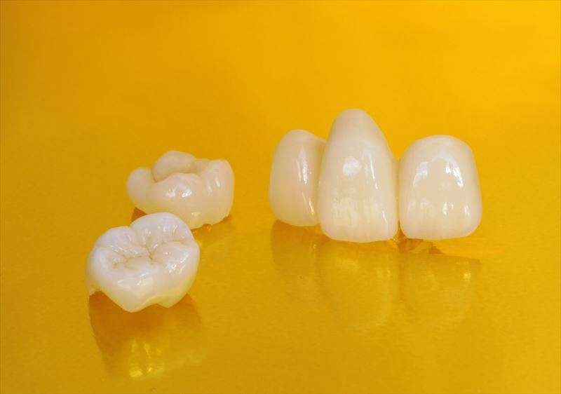 セラミック歯はメンテナンスが大切。どのくらいの頻度で行なうの？