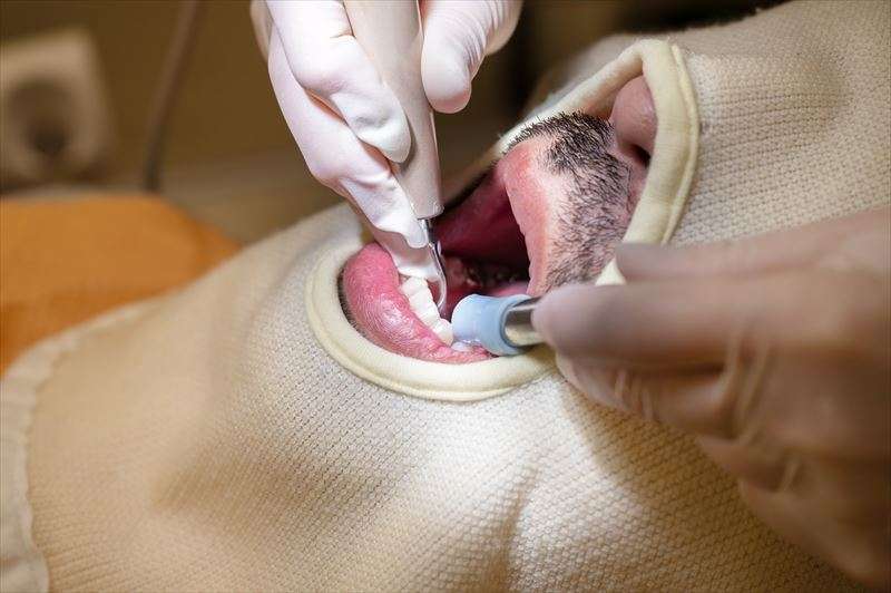 歯医者で定期検診を受けるメリットとは？