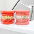 歯科矯正を行うメリットとは？